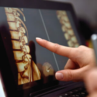 Functional recovery